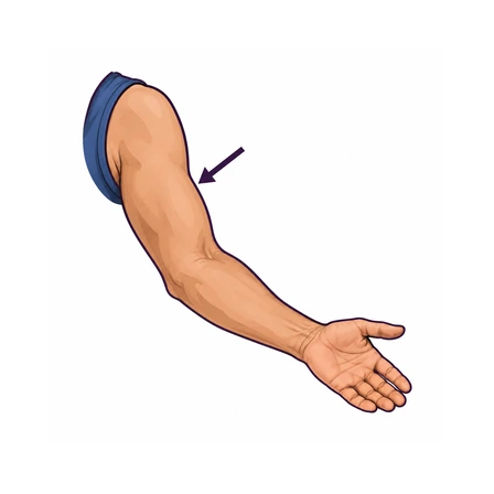 Brazo